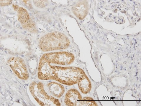 Monoclonal Anti-SERPINA3, (C-terminal) antibody produced