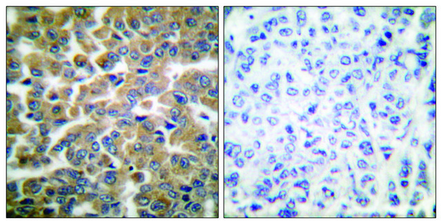 Anti-GR antibody produced in rabbit