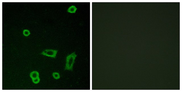 Anti-MTR1L antibody produced in rabbit