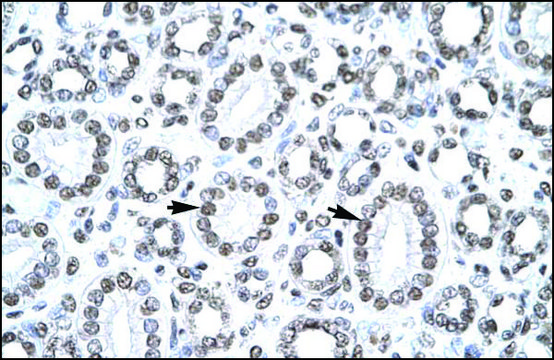 Anti-CITED1 antibody produced in rabbit