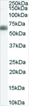 Anti-DKK3/REIC antibody produced in goat