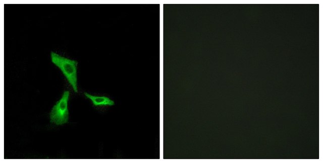 Anti-GPR101 antibody produced in rabbit