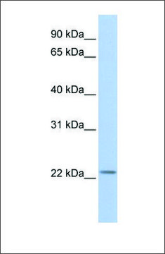 Anti-HIST1H1T antibody produced in rabbit