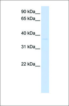 Anti-GDAP1L1 antibody produced in rabbit
