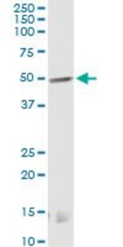 Monoclonal Anti-CNR1 antibody produced in