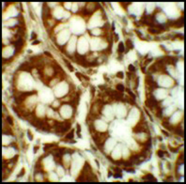 Anti-LRRFIP2 antibody produced in rabbit
