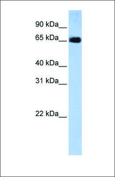 Anti-SLC22A13 antibody produced in rabbit