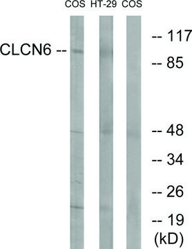 Anti-CLCN6 antibody produced in rabbit