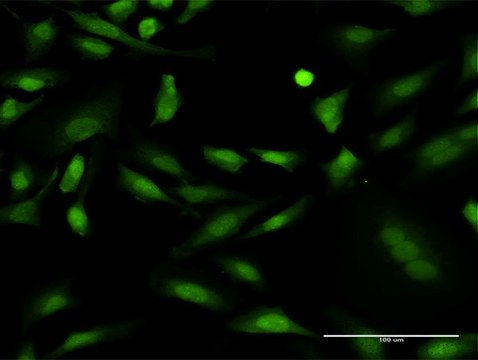 ANTI-PRKCD antibody produced in mouse