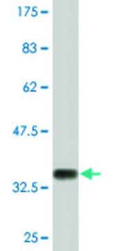 Monoclonal Anti-COL23A1 antibody produced in