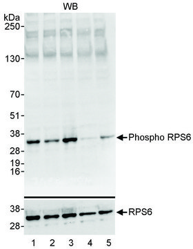 Rabbit anti-Phospho RPS6 (S235/236) Antibody,