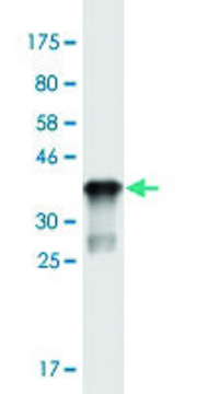 Monoclonal Anti-ST3GAL5 antibody produced in