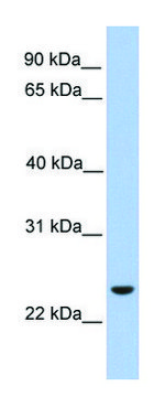 Anti-ORAI1 antibody produced in rabbit