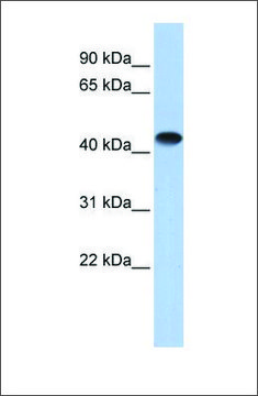 Anti-CKM (ab2) antibody produced in