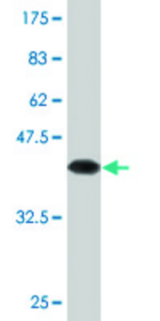 Monoclonal Anti-PTTG1, (N-terminal) antibody produced
