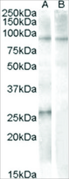 Anti-APOBEC2 (AA 12-26) antibody produced