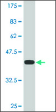 Monoclonal Anti-HECW2 antibody produced in