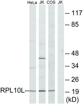 Anti-RPL10L antibody produced in rabbit