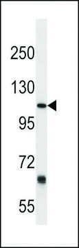 ANTI-PTGFRN (CENTER) antibody produced in