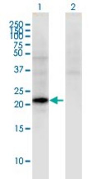 Monoclonal Anti-CGB5 antibody produced in