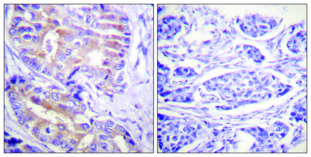 Anti-p70 S6 Kinase antibody produced