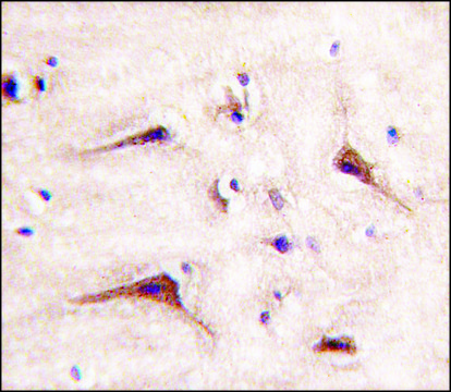 Anti-MUC20 (N-term) antibody produced in