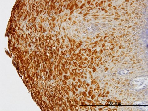 Monoclonal Anti-KRTHB1 antibody produced in