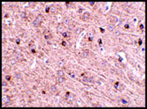 Anti-TOM70 antibody produced in rabbit