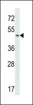 ANTI-ANKS4B (CENTER) antibody produced in