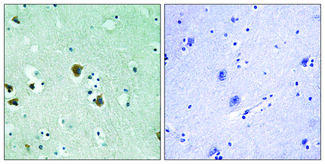 Anti-CRMP-2 antibody produced in rabbit