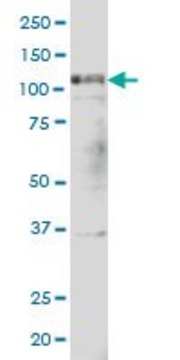 Monoclonal Anti-PTK2 antibody produced in
