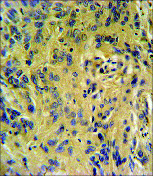ANTI-TESC (C-TERM) antibody produced in