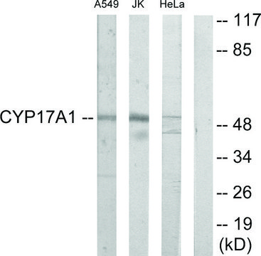 Anti-Cytochrome P450 17A1 antibody produced