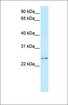 Anti-RCAN3 antibody produced in rabbit