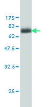 ANTI-MAGEA9 antibody produced in mouse