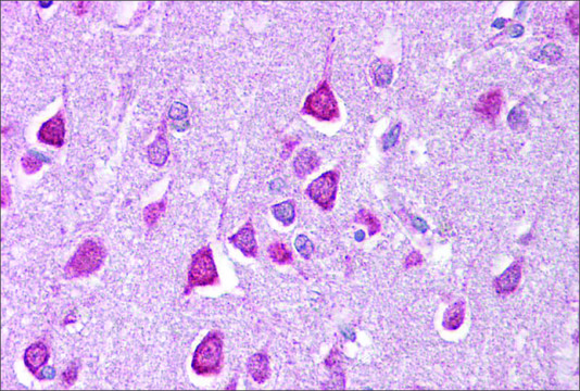 Anti-CACNA1G antibody produced in rabbit