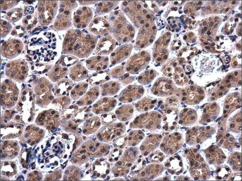 Anti-ZC3H12A antibody produced in rabbit