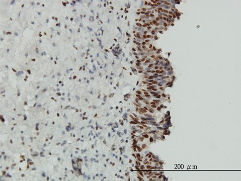 Monoclonal Anti-EWSR1 antibody produced in