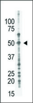 Anti-BDP1 (N-term) antibody produced in