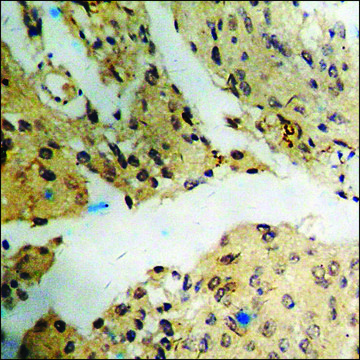Anti-phospho-ATF2 (pThr71 or 53) antibody