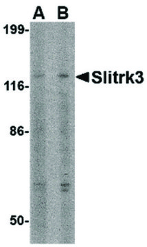 Anti-SLITRK3 antibody produced in rabbit