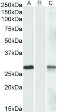 Anti-DYDC1 antibody produced in goat