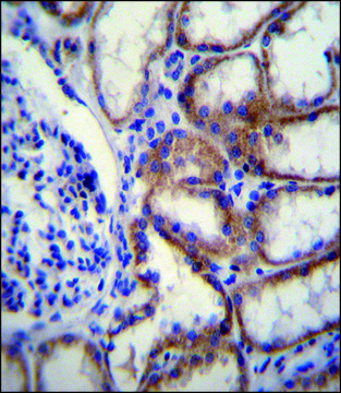 ANTI-COL8A2 (C-TERM) antibody produced in