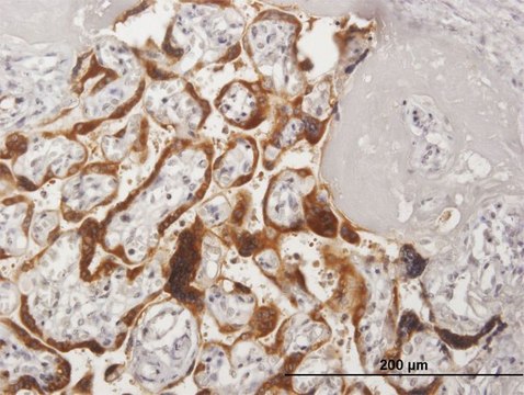 Anti-CSH2 antibody produced in mouse