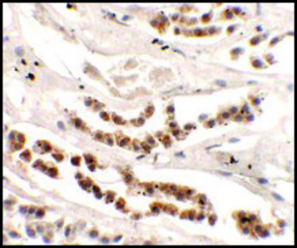 Anti-DISP1 antibody produced in rabbit