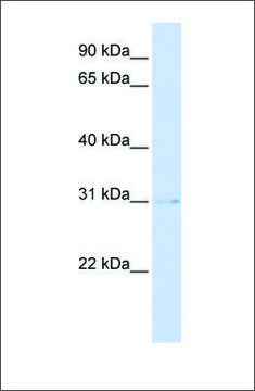 Anti-PVRIG antibody produced in rabbit