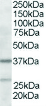 Anti-ARP2/3 subunit 1B antibody produced