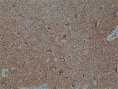 Anti-Spastin antibody, Rabbit monoclonal