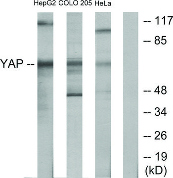Anti-YAP antibody produced in rabbit
