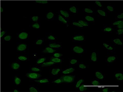 Monoclonal Anti-LSM6 antibody produced in